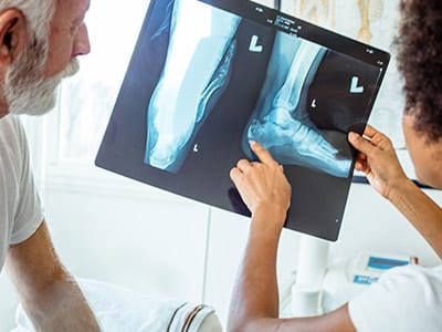 X RAY